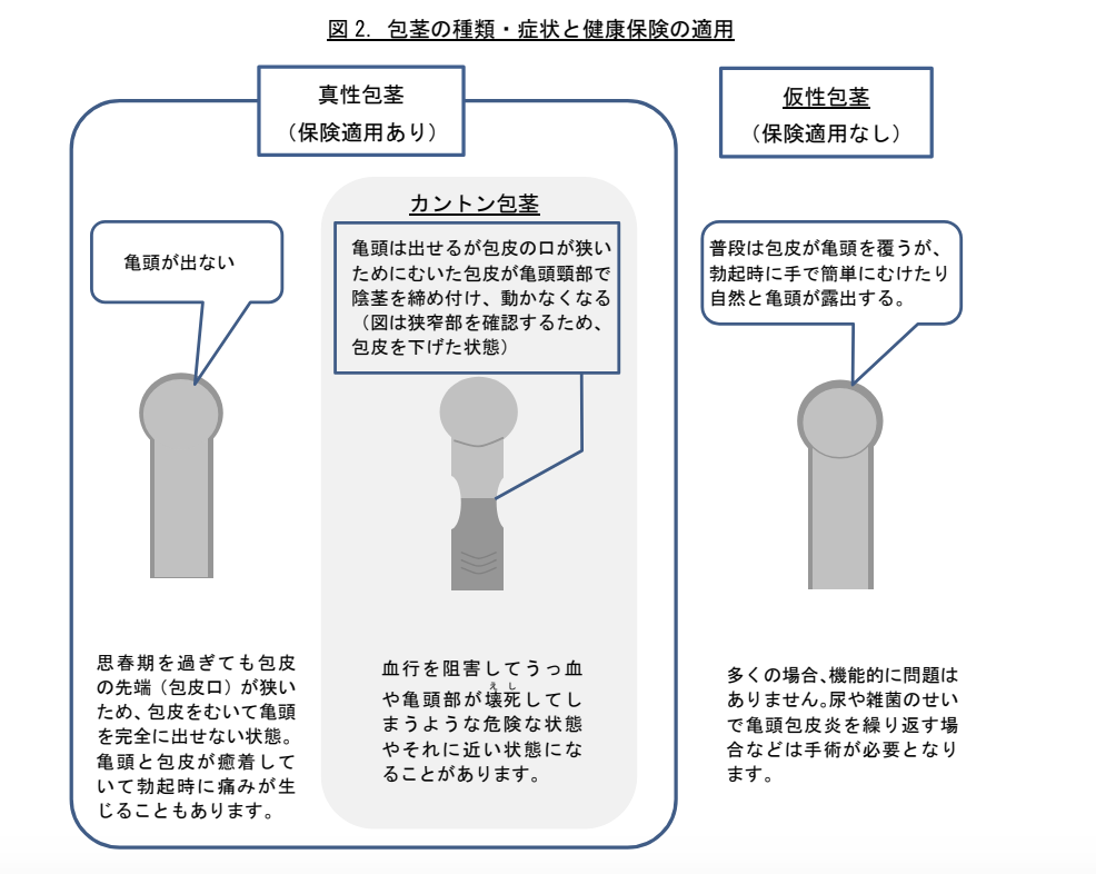 包茎手術は保険適用になる？