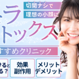 エラボトックスのおすすめ記事