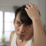 生え際が気になる男性アイキャッチ