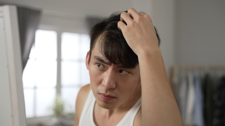 生え際が気になる男性アイキャッチ