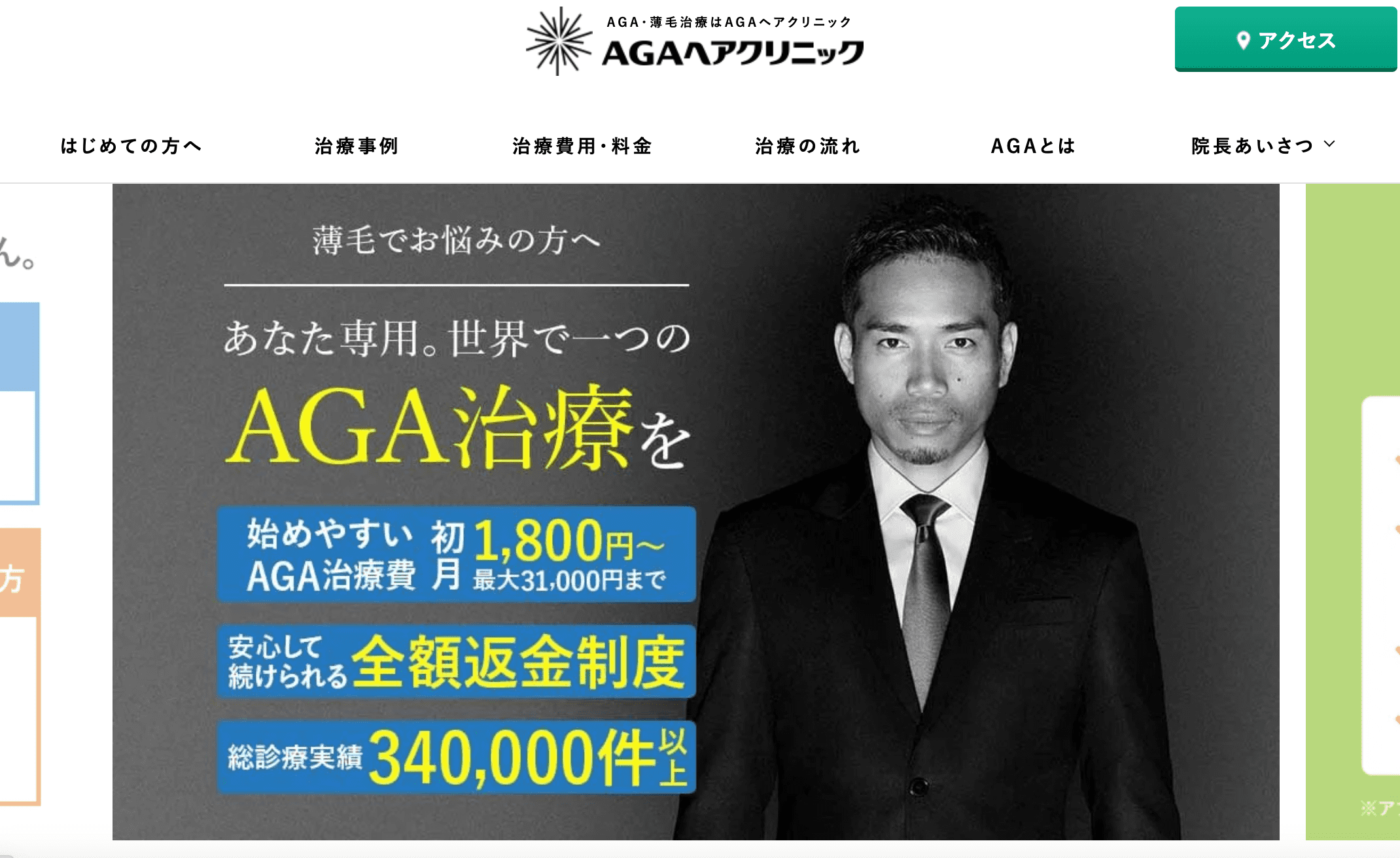 AGAヘアクリニックは抑える・生やすが得意